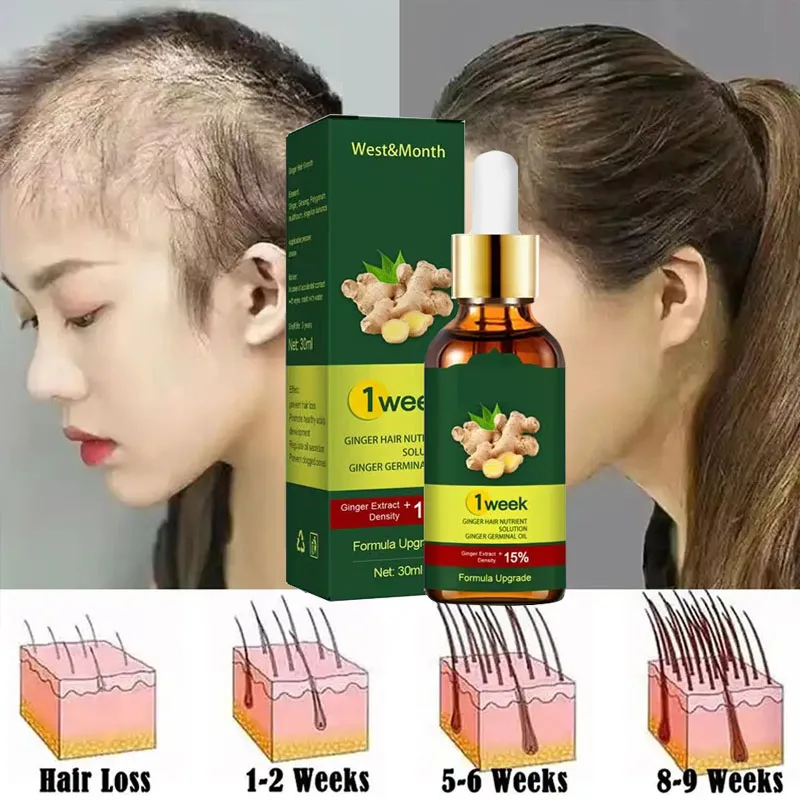 Продукты для роста волос Ginge – обзор и цена Licorice Root Sticks